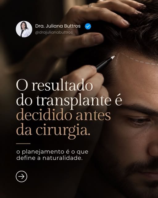 Quase todo homem que chega ao consultório pergunta quantos folículos vai precisar. É uma pergunta im