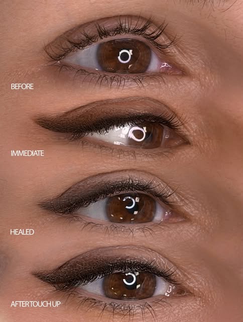 FROM BEFORE TO THE FINAL HEALED

RESULT
Permanent eyeliner is a process, and each stage of healing p