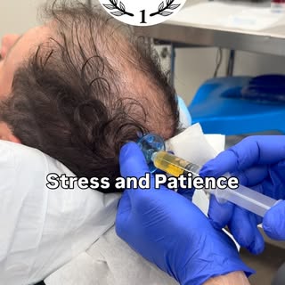 Starting your hair restoration journey requires patience above all else. While many believe a proced