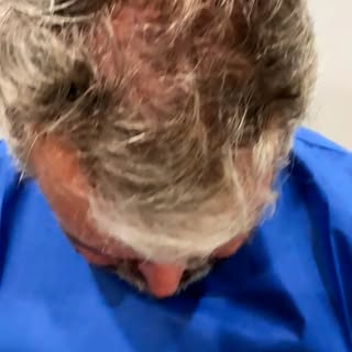 At Dr. Hair of Chicago, we believe the secret to a successful hair transplant lies in the details—lo