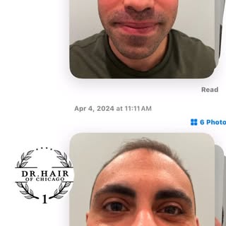 At Dr. Hair Chicago, we don’t just jump into surgery — we practice medicine at its best.

Every hair