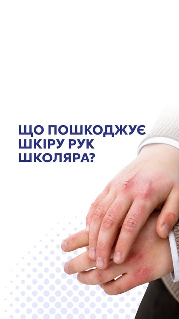 Червоні й потріскані руки у дитини — не завжди алергія. Часте миття, мило та холод можуть пошкоджува
