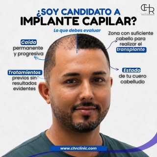 💭 ¿Estás pensando en un implante capilar? 👨‍⚕️🦱 Esto es lo primero que debes saber.

No todas las