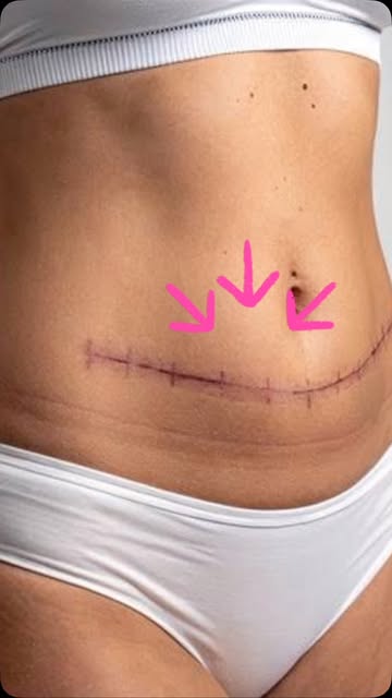 एक तरफ़ धर्म एक तरफ़ कर्म #cosmeticsurgery #botox #skincare #skin #laser