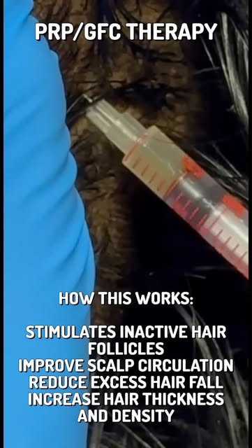 ✨ PRP & GFC for Hair Loss | Stronger Roots, Healthier Hair ✨

Hair thinning, increased hair fall or 