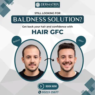 Unlock your ultimate hair glow-up and rock those vibes with DERMATRIX's hair GFC! 🌟🔥 

#DermatrixG