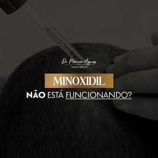 O Minoxidil não está funcionando para você? Preciso te contar algo.