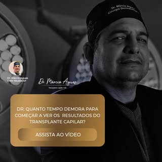 O transplante capilar exige paciência, mas os resultados valem a espera. Saiba em quanto tempo você 