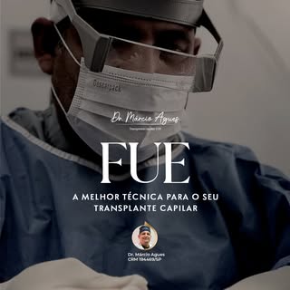 Técnica FUE: uma das mais avançadas para transplante capilar. Com ela, ofereço um resultado natural 
