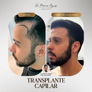 Ver a evolução dos meus pacientes é uma das melhores partes do meu trabalho! Acompanhe o antes e dep