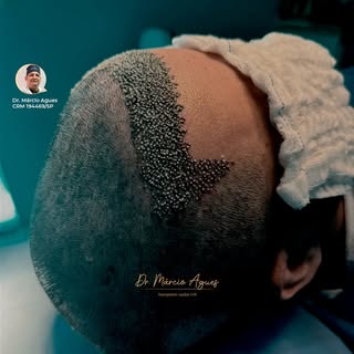 A beleza do processo está nos detalhes que garantem um crescimento saudável e natural!