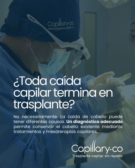 ¿Toda caída capilar necesita un trasplante? 🤔
La respuesta es: no siempre.

Antes de hablar de ciru