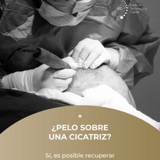 Ya sea por un accidente de la infancia, una cirugía antigua o una caída, tener una cicatriz en el cu