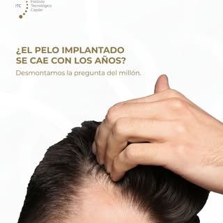 Es, sin duda, la pregunta estrella en nuestra clínica de Málaga: “Doctor, si me hago el injerto ahor