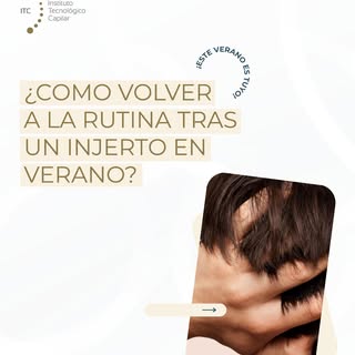 Aprovechar las vacaciones de julio para hacerte tu injerto capilar en nuestra clínica de Málaga es u