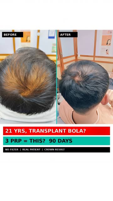 21 साल में transplant बोल दिया? 😡

Jodhpur के एक clinic ने इस patient को बोला - आपका तो अब transpla