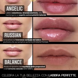 💋 Ogni sorriso ha la sua forma.
Ecco in quanti modi la dottoressa Carmela Cuomo può trattare le lab