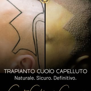 ✨ Un nuovo inizio parte dai capelli.
 Con il trapianto di cuoio capelluto al 𝗖𝗲𝗻𝘁𝗿𝗼 𝗖𝗵𝗶𝗿𝘂