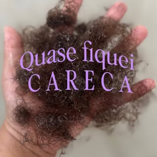 Nem toda queda é anormal, você sabia?!

Dependendo da quantidade de dias que você fica com o cabelo 