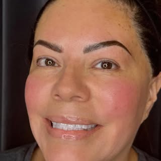 Nano Combo Brows (also called Nano Combo, Combo Brows, or Hybrid Brows) are a permanent makeup brow 