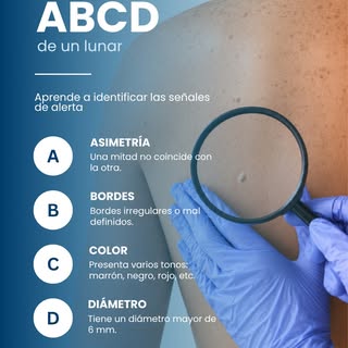 🔎 ¿Conoces la regla ABCD de los lunares? 

La regla ABCD puede ayudarte a identificar algunas señal