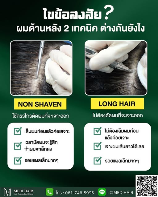 ไขข้อสงสัย 💡 ปลูกผมแบบไม่โกนผมทั้งศีรษะ "Non-Shaven FUE กับ Long Hair FUE" ต่างกันอย่างไร?

🗯️ ทั้