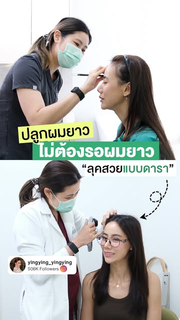 K’หญิงหญิง ปลูกผมยาวครบ 4 เดือน ✨แนวผมดูสวยขึ้น กรอบหน้าดูรับเข้ากับรูปหน้ามากขึ้น จะปล่อยผม มัดผมรบ