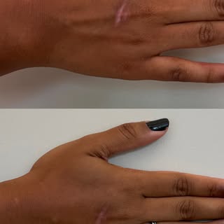 ✨Nem toda cicatriz é apenas estética.
Algumas carregam traumas, histórias e por vezes inseguranças s