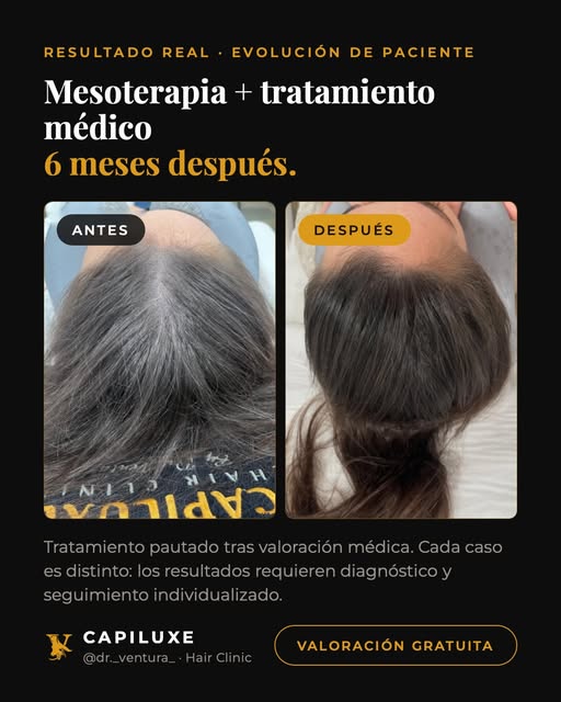 ¿Te ves la raya más ancha que hace un año?

No siempre significa lo mismo, y por eso no se trata igu