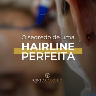 Qual o segredo da hairline perfeita?

Como garantir um resultado de excelência e extremamente natura