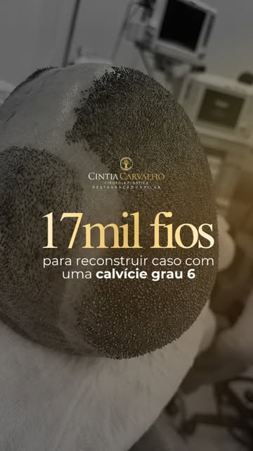 Ele já conhecia a nossa história antes mesmo de ser paciente!

Foram quatro anos se programando pra 