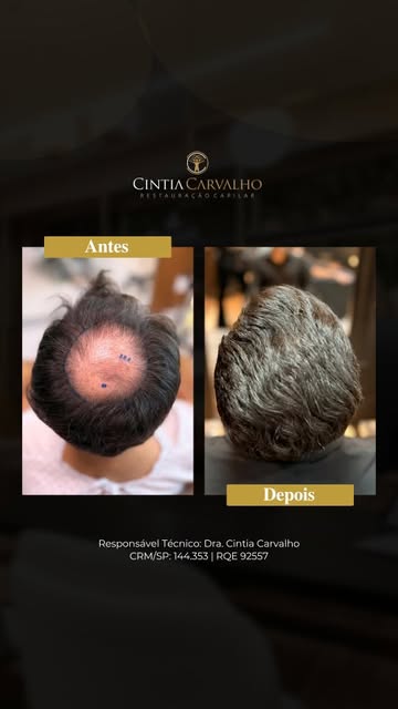 Alguns resultados mostram a diferença de forma muito clara, e o do Emerson é um deles.

A comparação