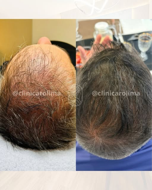 ✨ O resultado está nos detalhes.

Um antes e depois que revela evolução, cuidado e acompanhamento.

