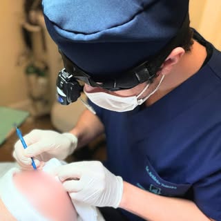 O sucesso de um transplante capilar está na soma de pequenos detalhes executados com excelência.

Na