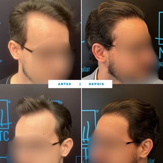 Um resultado que evidencia como o planejamento e a técnica fazem diferença na recuperação da linha f