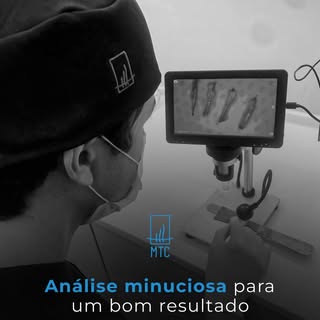 A análise minuciosa de cada folículo permite um planejamento mais preciso, considerando as caracterí