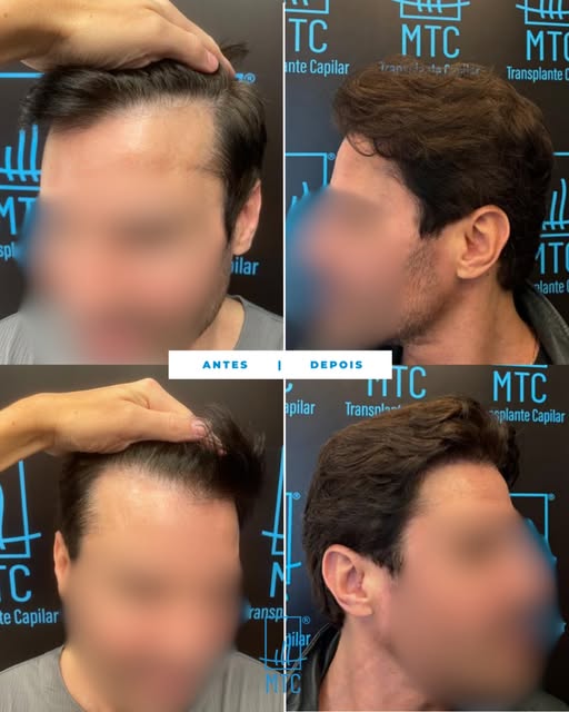 Planejamento, precisão e naturalidade.

Alcançamos um resultado sofisticado e harmônico, respeitando