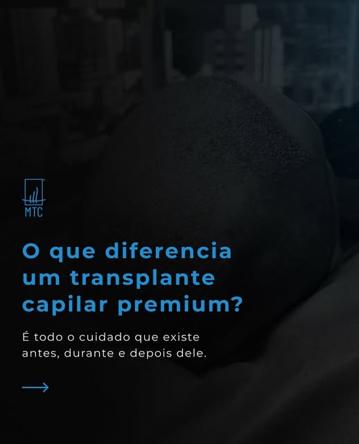 Um transplante capilar premium está nos detalhes: no planejamento, na precisão e, principalmente, no