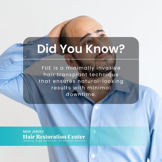 Did you know? FUE is a minimally invasive hair transplant technique that ensures natural-looking res