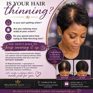 #MajesticallyHair #HairTopper #HairLossSolutions #NonSurgicalHairReplacement #HairLossSpecialist Thi