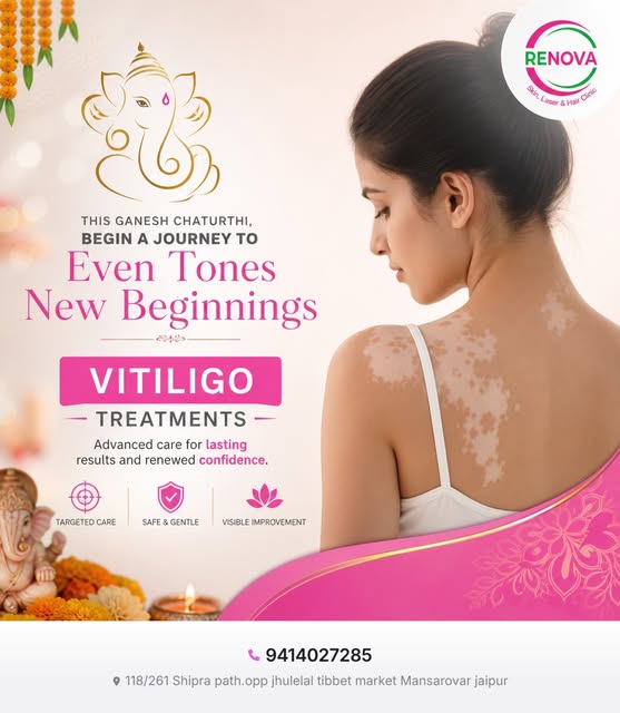 Renova Skin Laser & Hair Clinic offers advanced vitiligo treatments to effectively manage skin condi