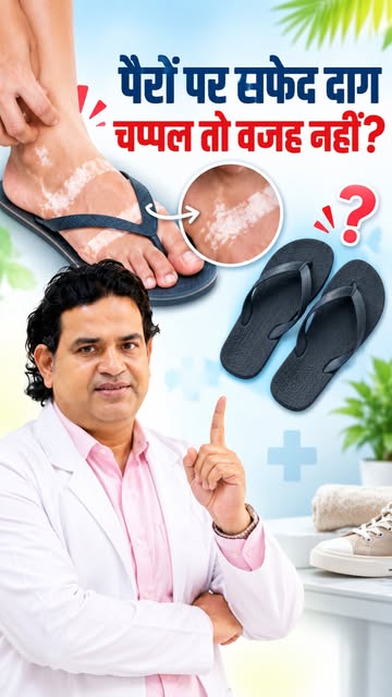 चप्पल की Strap के निशान पर ही सफेद दाग? 👣

अगर Plastic या Rubber की चप्पल पहनने के बाद उसी जगह खुजल