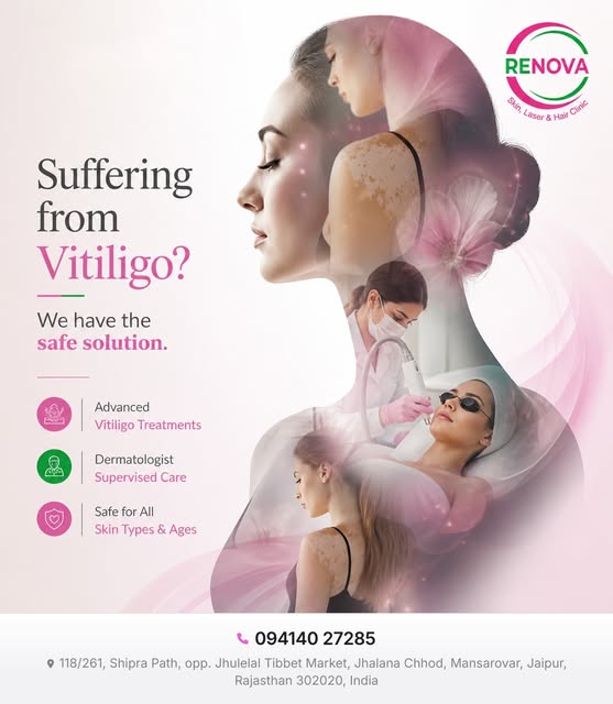 Discover expert vitiligo treatments at Renova Skin Laser & Hair Clinic, your trusted skin care clini
