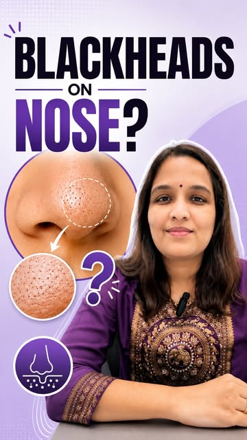 👃 Those “Blackheads” on Your Nose May Not Be Blackheads!

Not every tiny dark spot or dot on the no