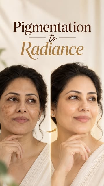 ✨ Makeup can conceal pigmentation, but healthy skin starts with understanding its cause.

Pigmentati