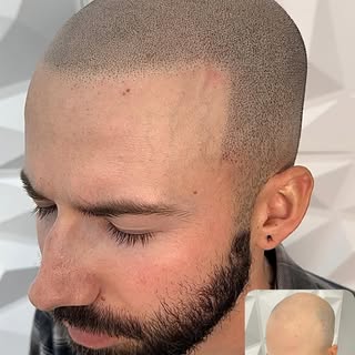 REALISM SMP 

We guarantee life changing results! 

BOOK A FREE CONSULTATION 

Visit: 
www.gotscalp.