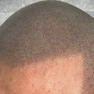 Up close! 🔎

Realism technique places the impressions really close together but at different depths