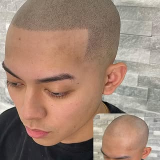 EDGE UP + FADE

REALISM TREATMENTS

Natural results! 👑

BOOK A FREE CONSULTATION 

DM for details o