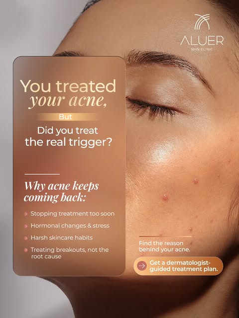 Acne is not just about the breakout you see.
Sometimes, the real cause lies beneath the surface.

Fr