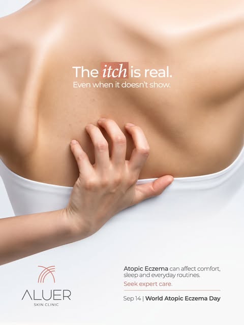 The itch may not always be visible, but the discomfort is real. Atopic eczema can affect your sleep,
